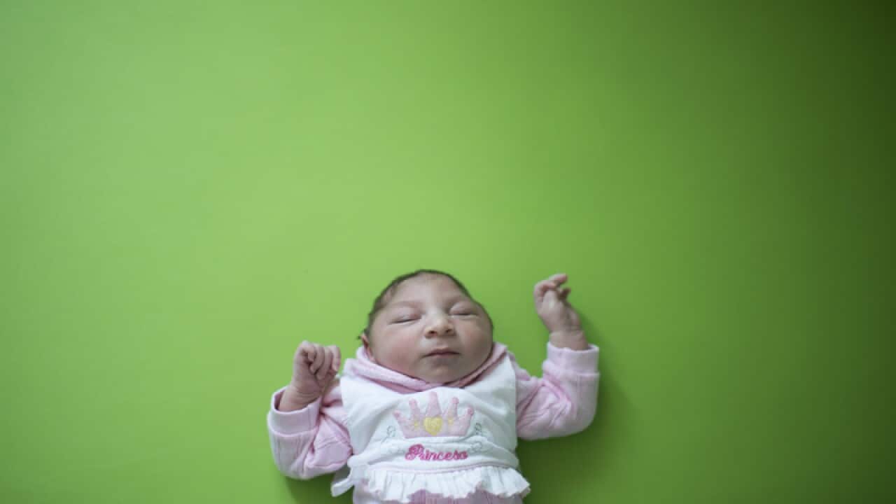 Sophia, who is two weeks old and was born with microcephaly