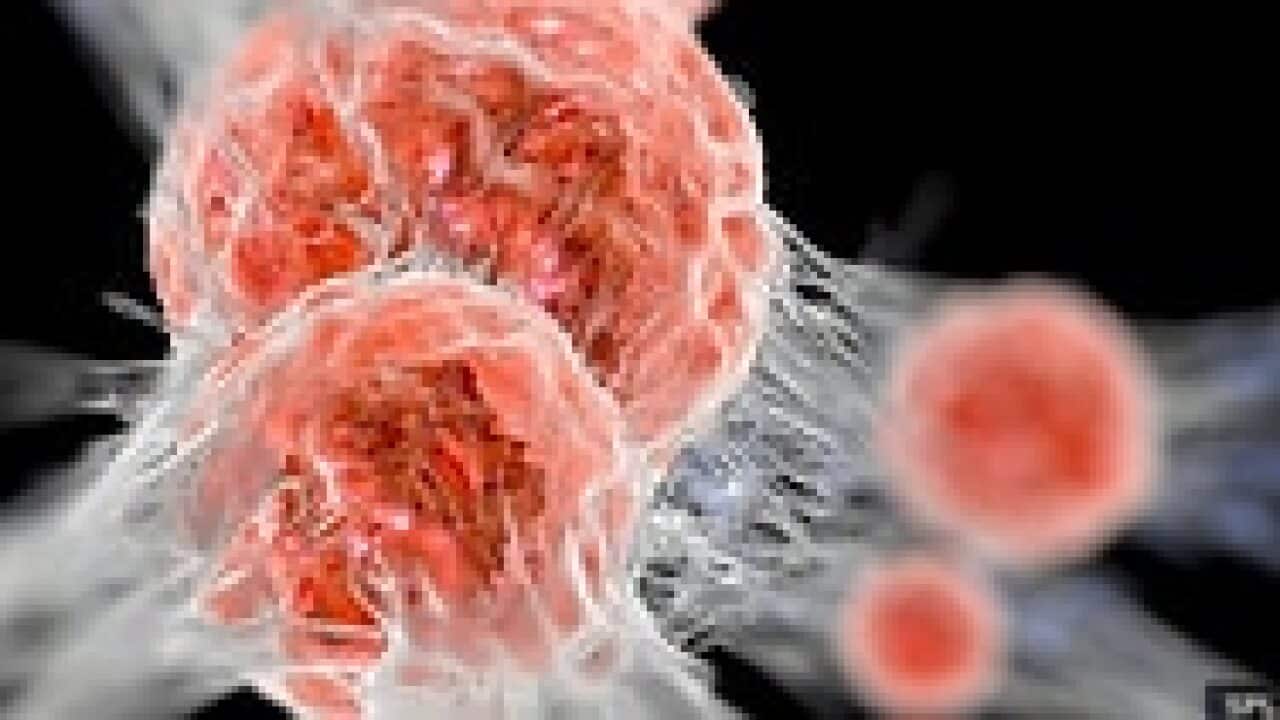 Cancer cells