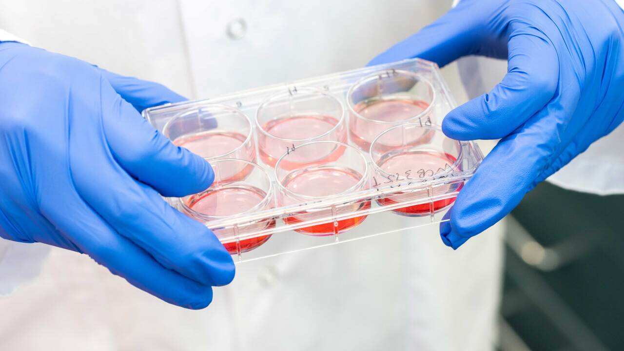 Organoid tray used in bowel cancer research (supplied by WEHI).jpg