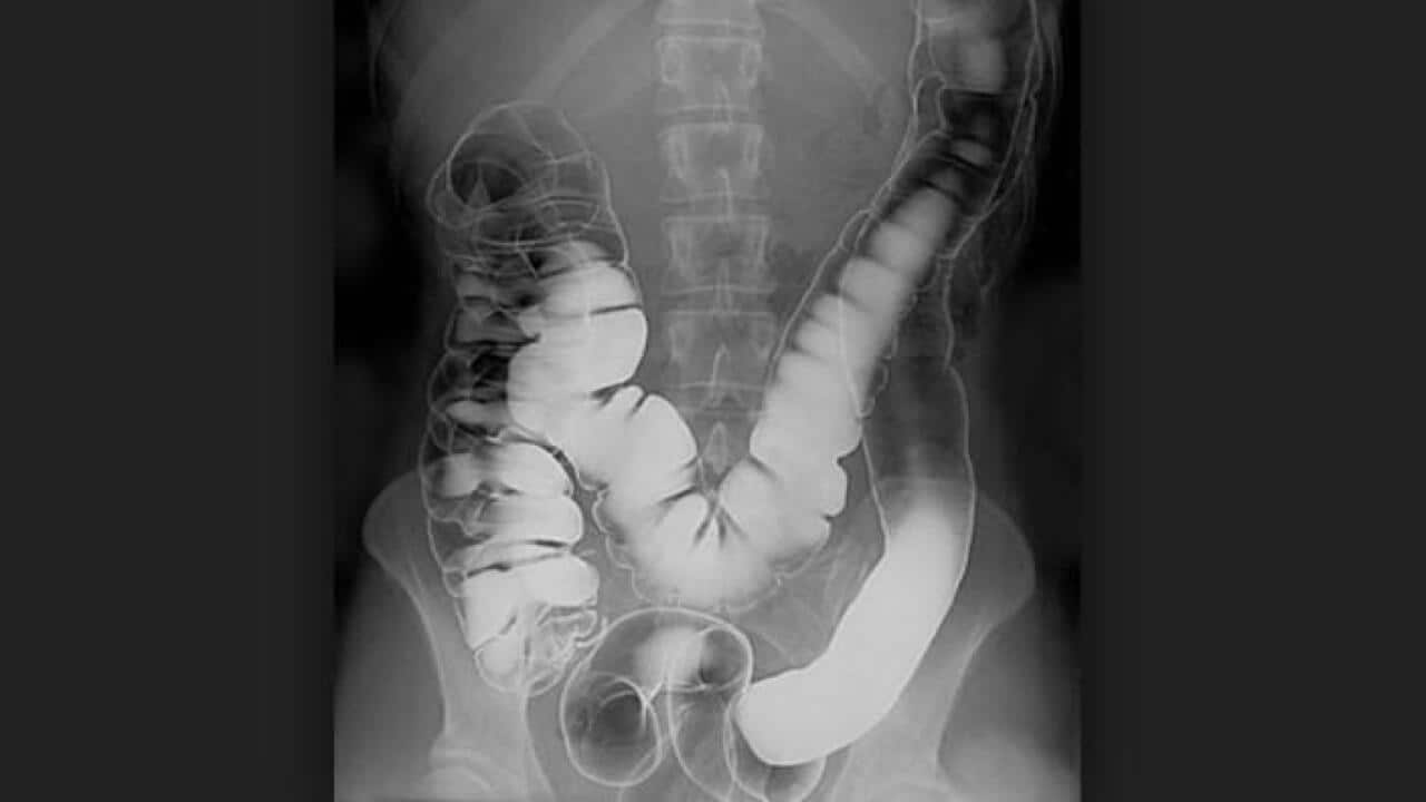 Image for read more article 'READ MORE'