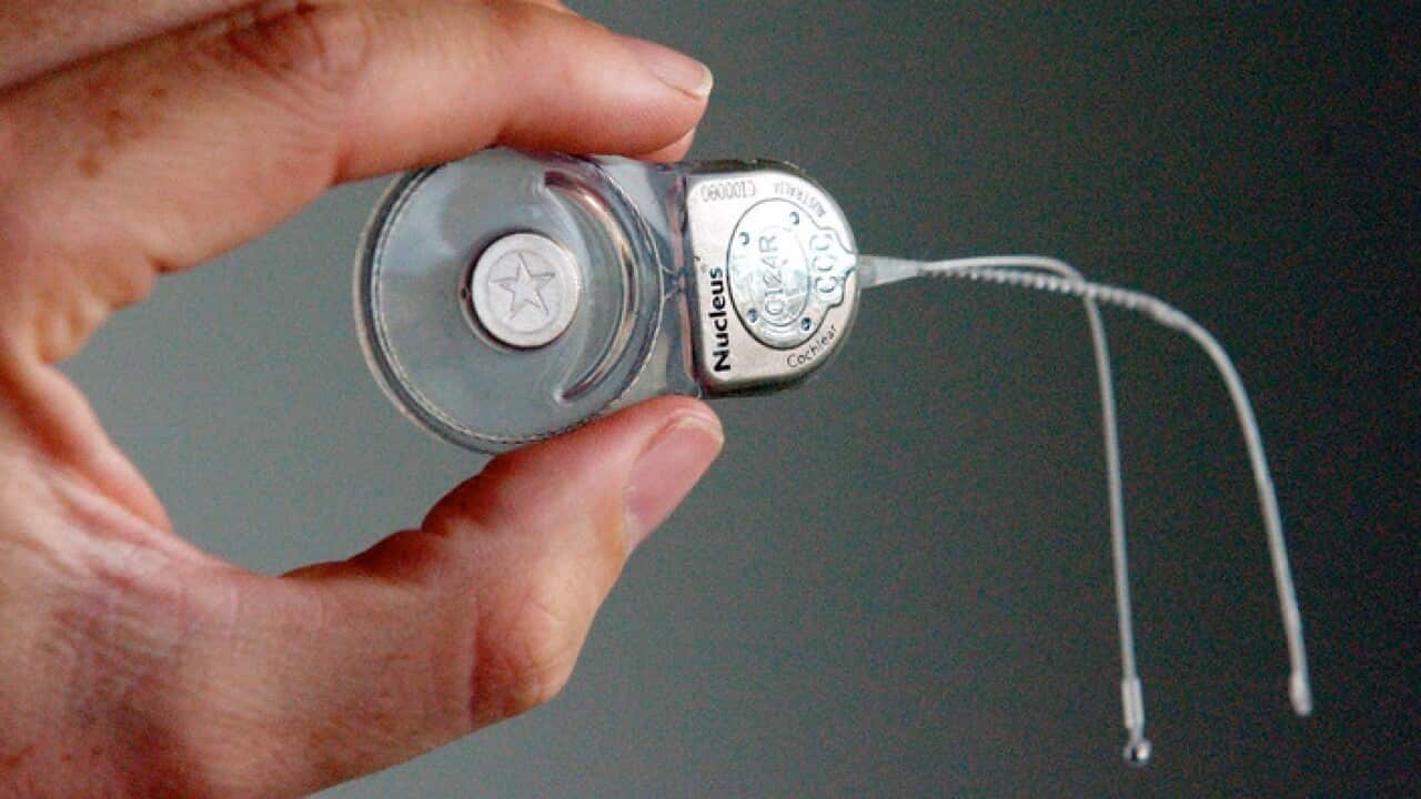 A Cochlear implant