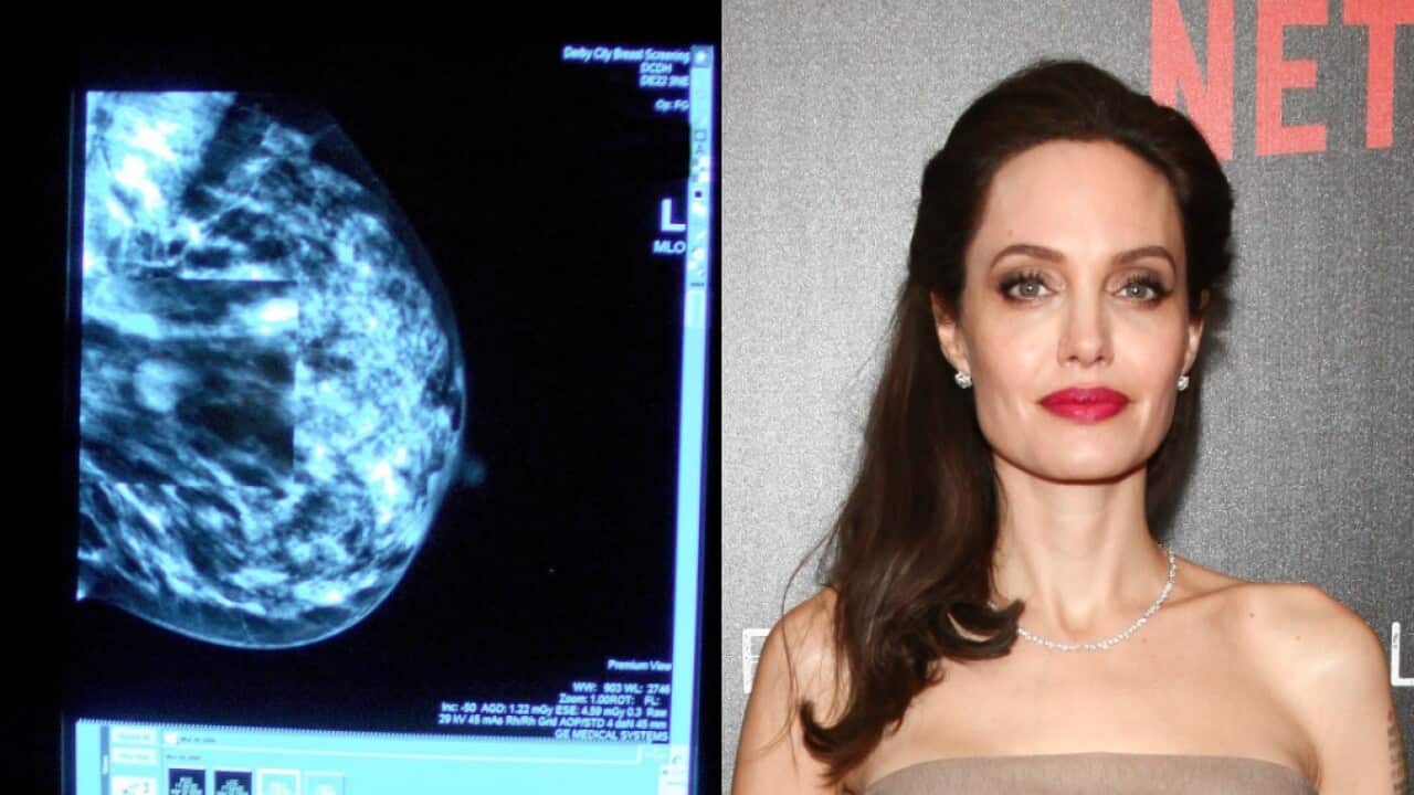 she revealed she underwent a double mastectomy after discovering she carried the