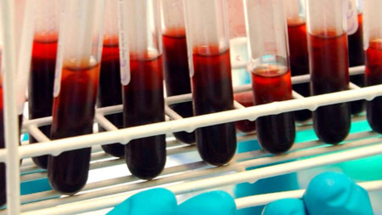 doping_blood_test_100527_B_aap_1970777690