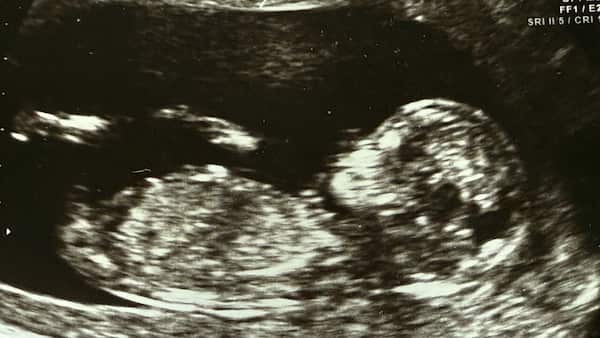 "Very rare" IVF mixup expected to lead to renewed policies, regulation image