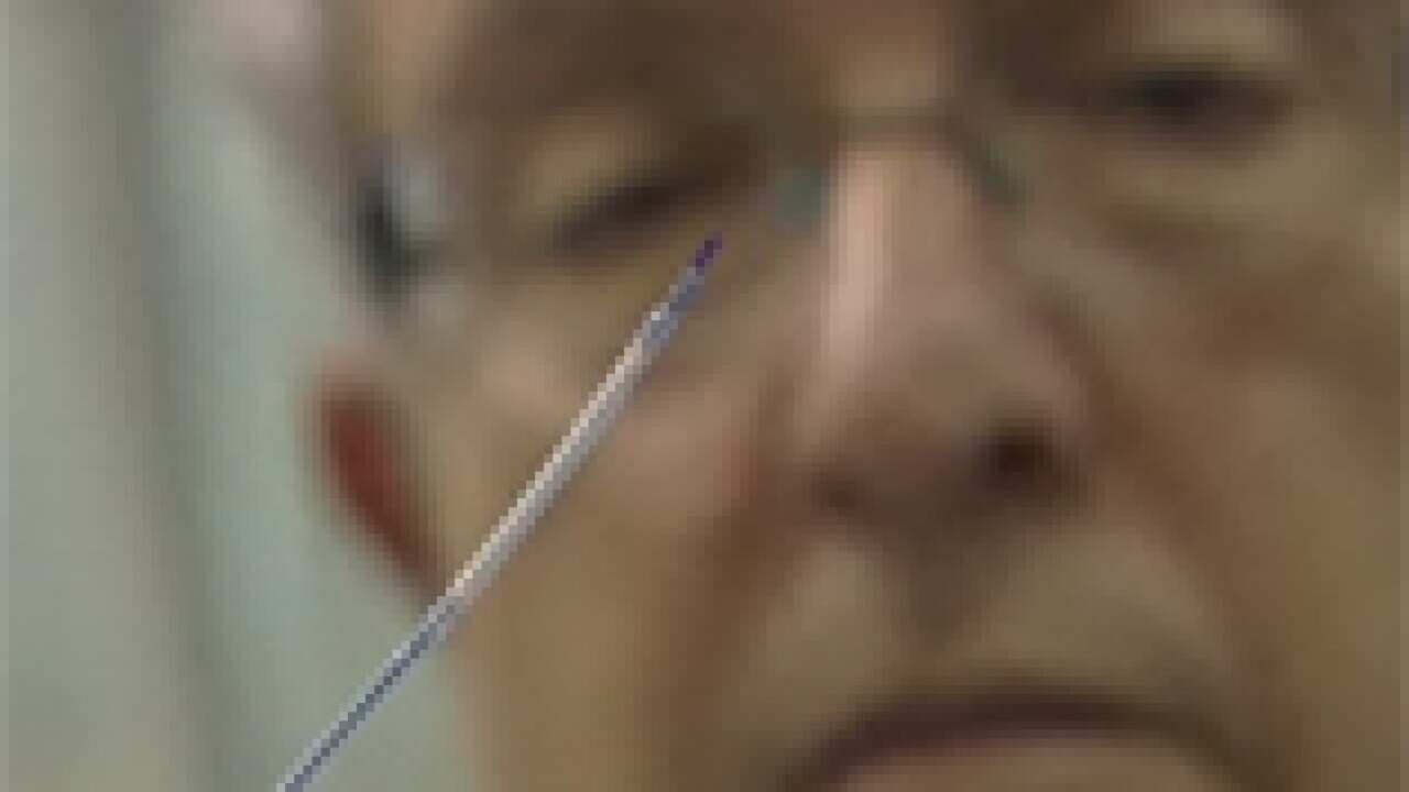 stent_b_091028_bbc_1170973988