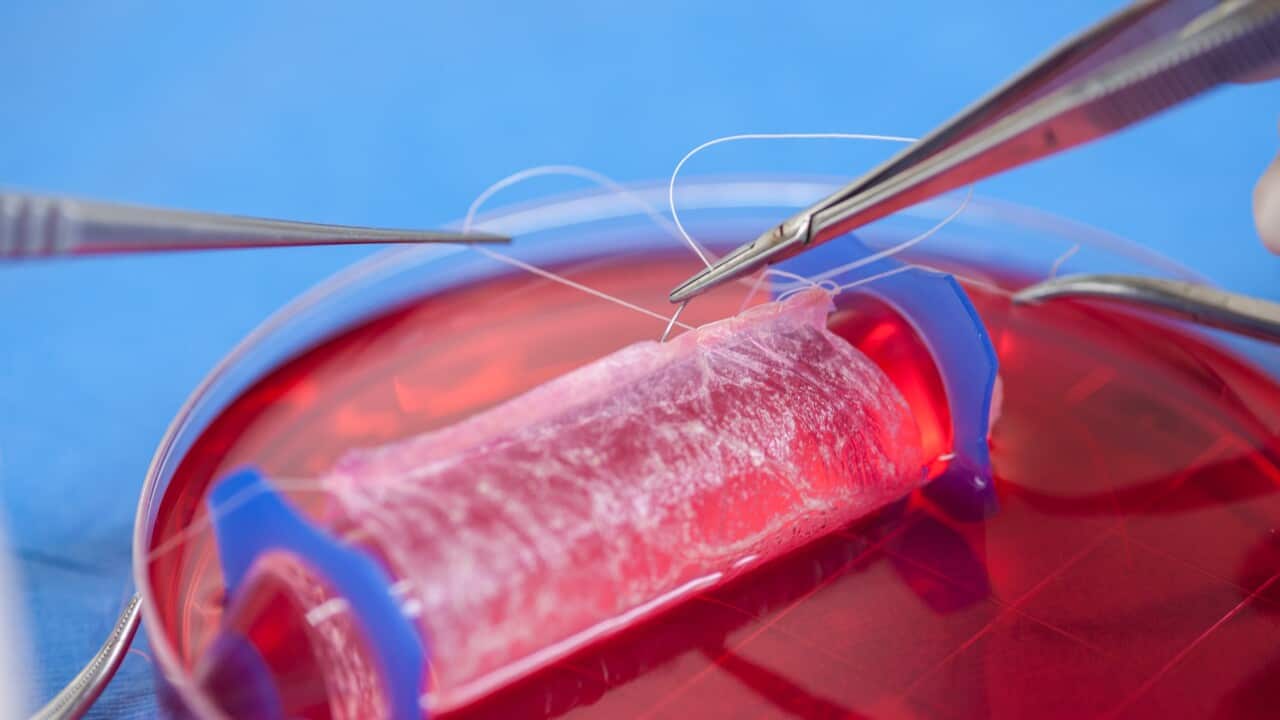 Cells are placed onto biodegradable “scaffolds” which are hand-sewn into a vagina-like shape.  (Photo: Wake Forest Institute for Regenerative Medicine)
