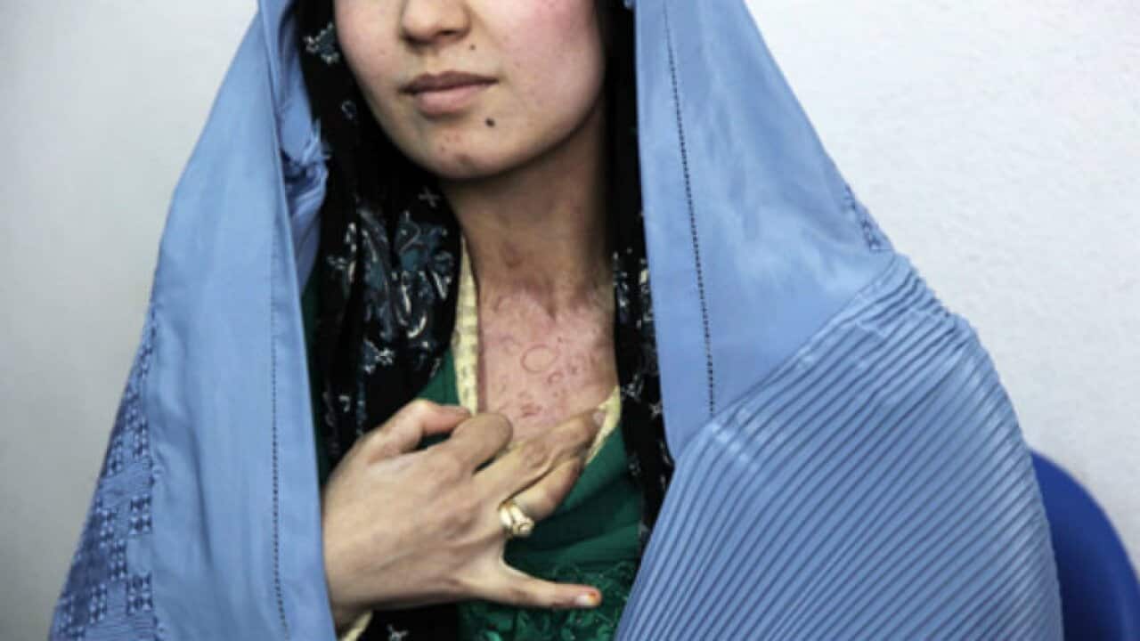 Afghan Woman who is a victim of domestic violence