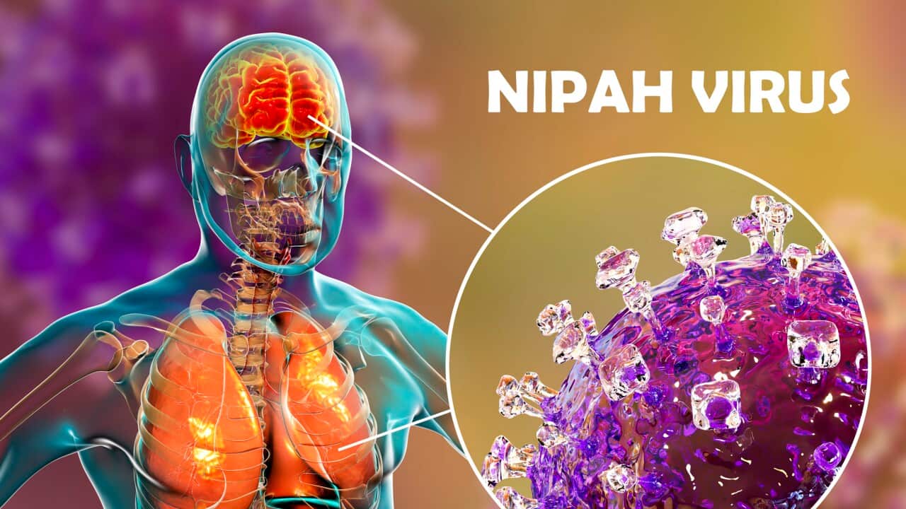 Encephalitis caused by Nipah viruses, illustration