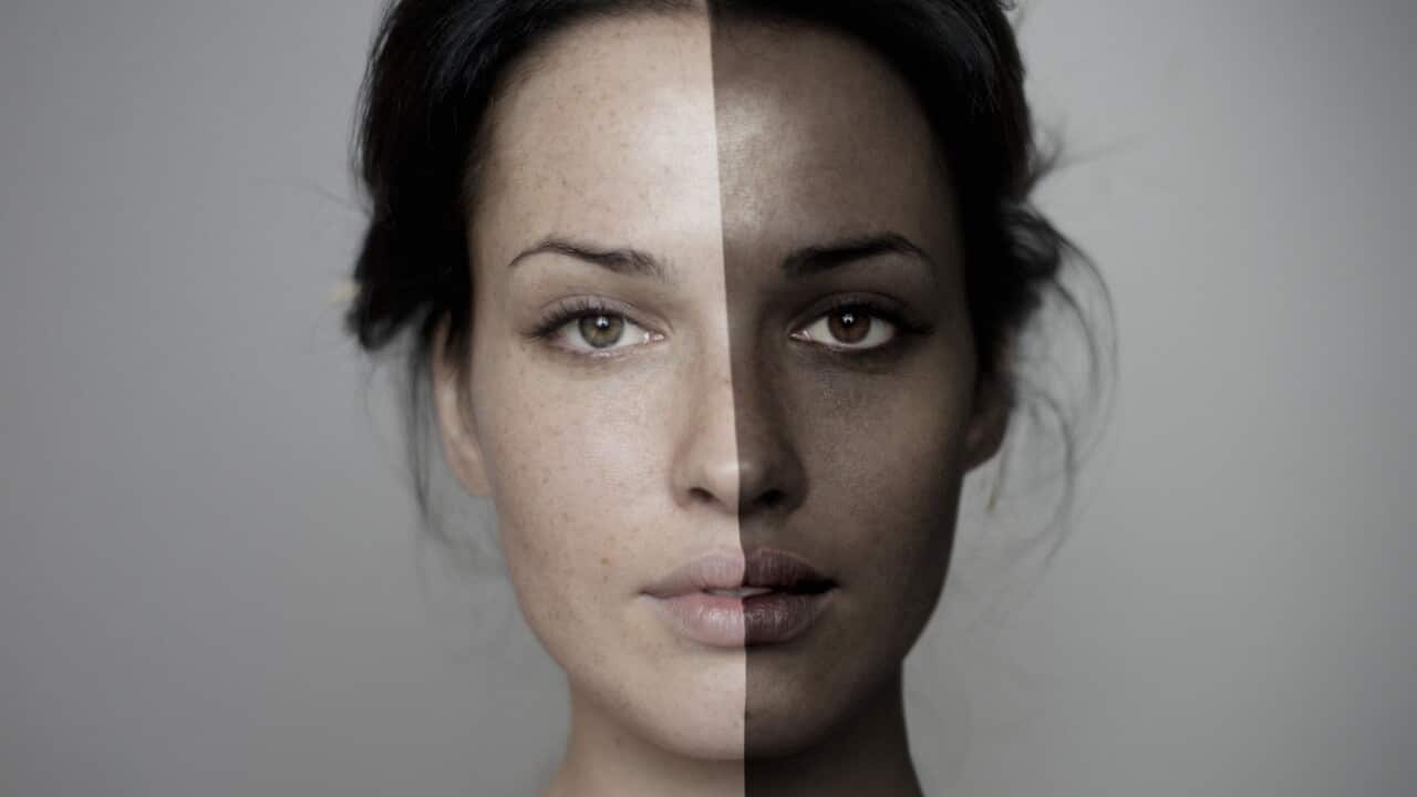 Can a person be trans-race (or trans-racial)? Is race, like sexual orientation, a fluid and transferable label? 
