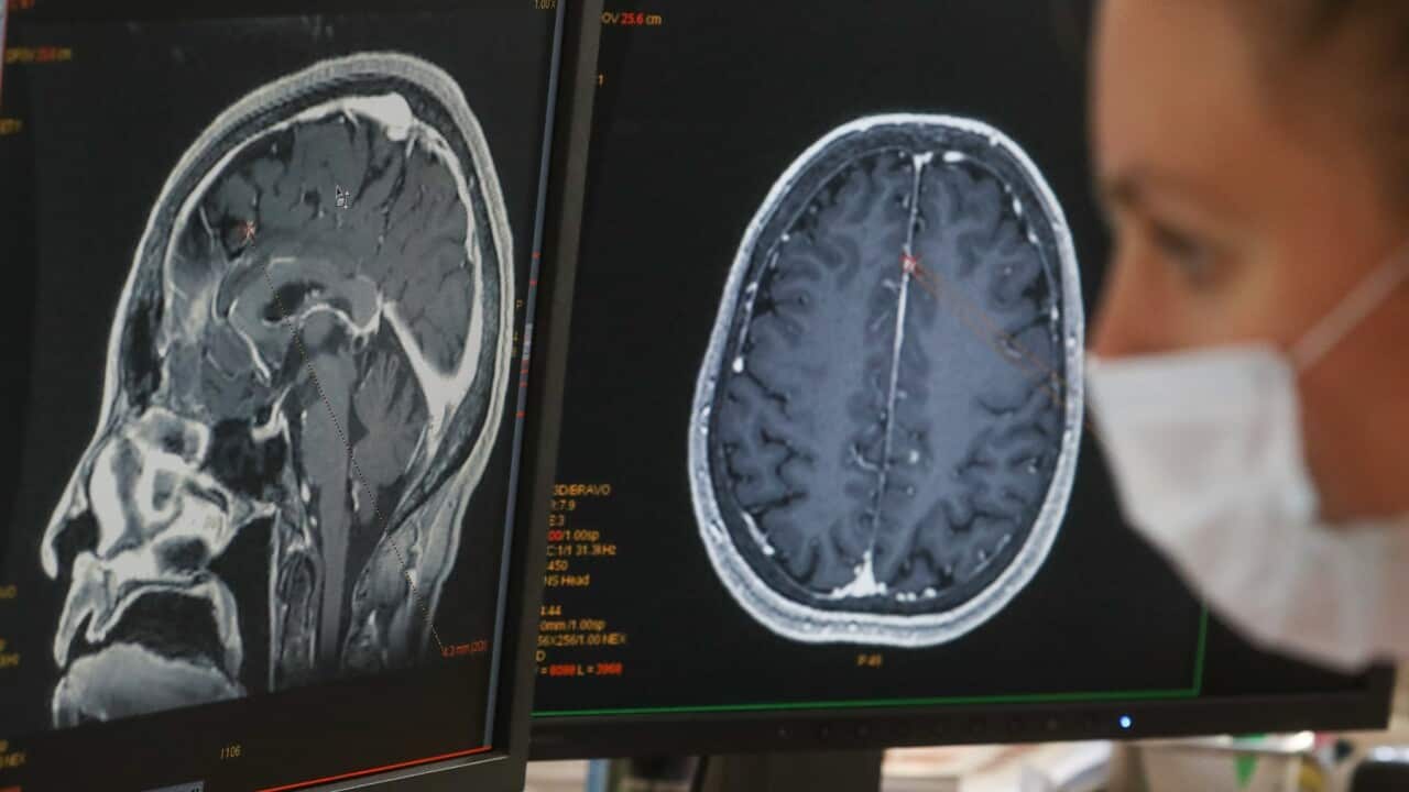 A screen showing scans from a magnetic resonance imaging