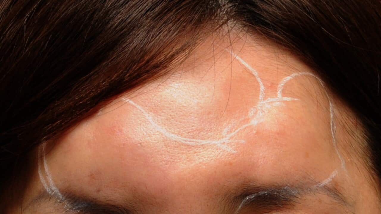 Janet Kim has been suffering complications from illegal cosmetic procedures