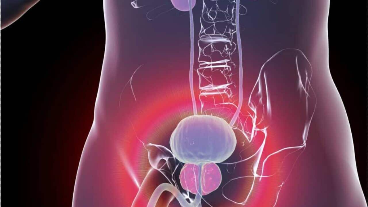 Benign prostatic hyperplasia, illustration.jpg