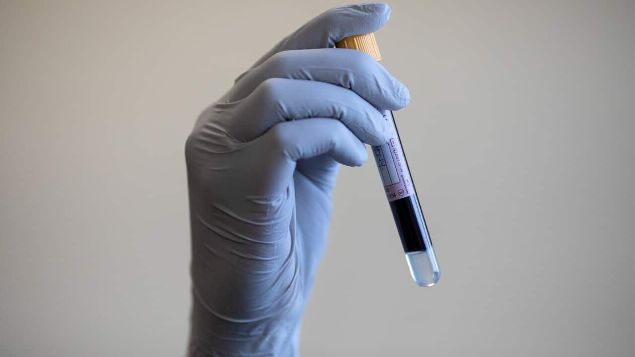 Blood sugar levels study