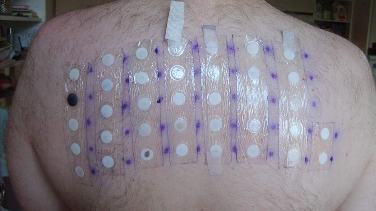 ANAPHYLAXIS