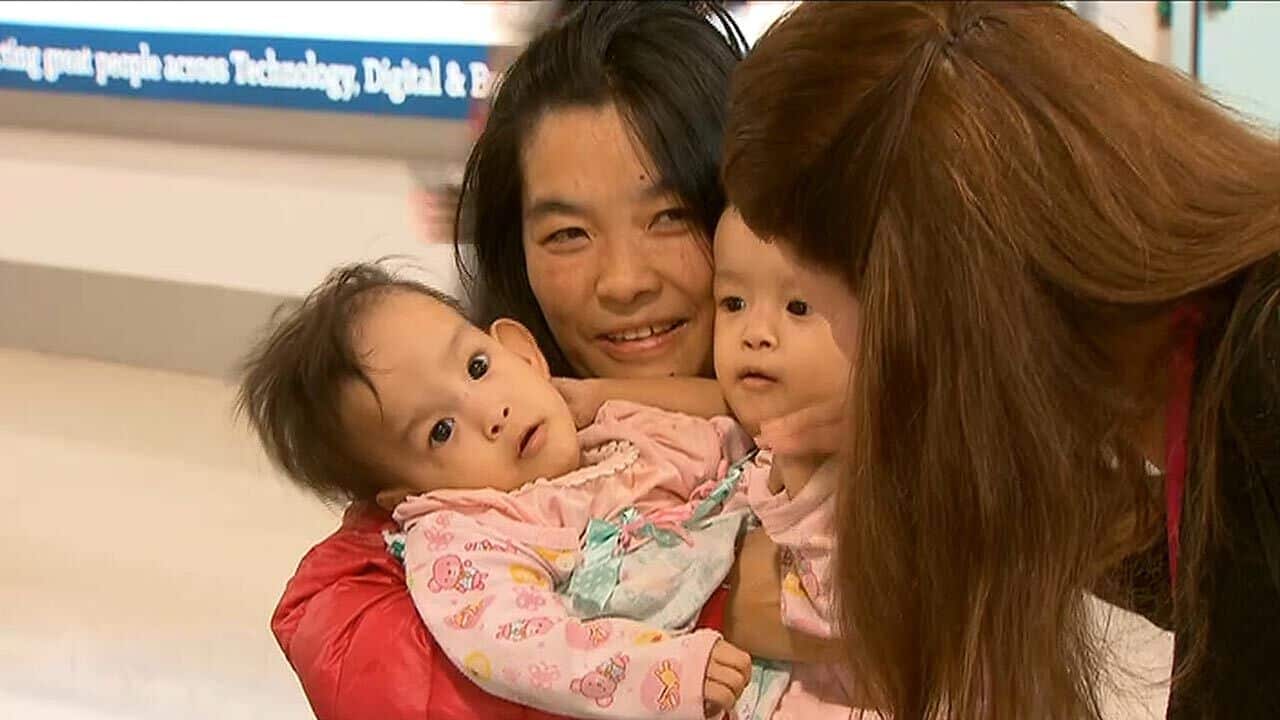 The conjoined 14-month-old twins have arrived in Melbourne from Bhutan.