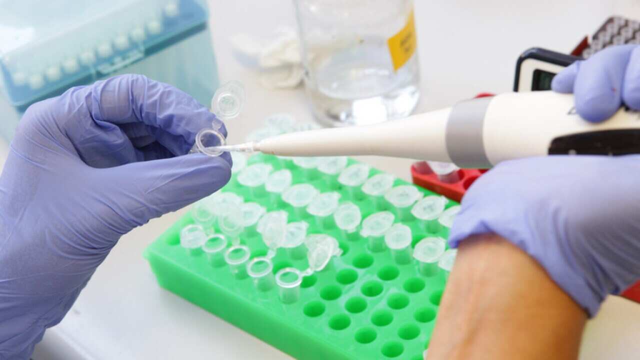 A scientist works in a medical lab at St Vincent's Institute in Melbourne