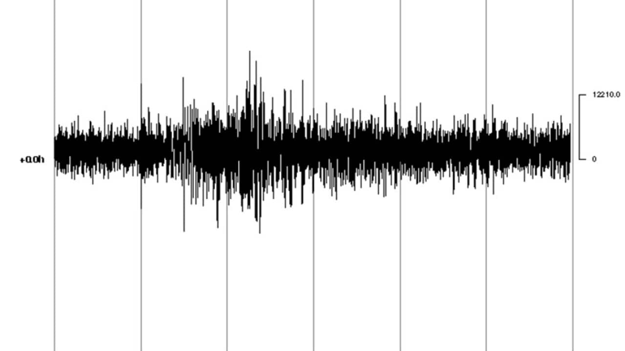 Image for read more article 'Related reading'