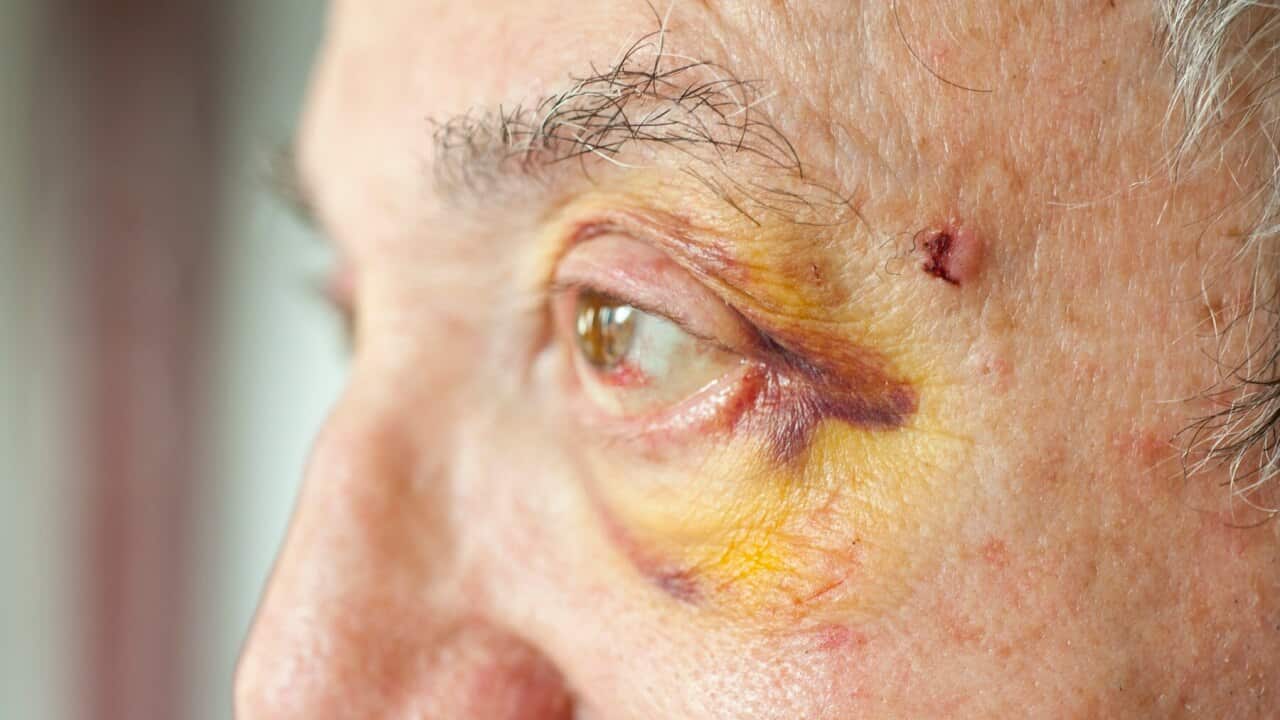 Image for read more article 'আরও দেখুন:'