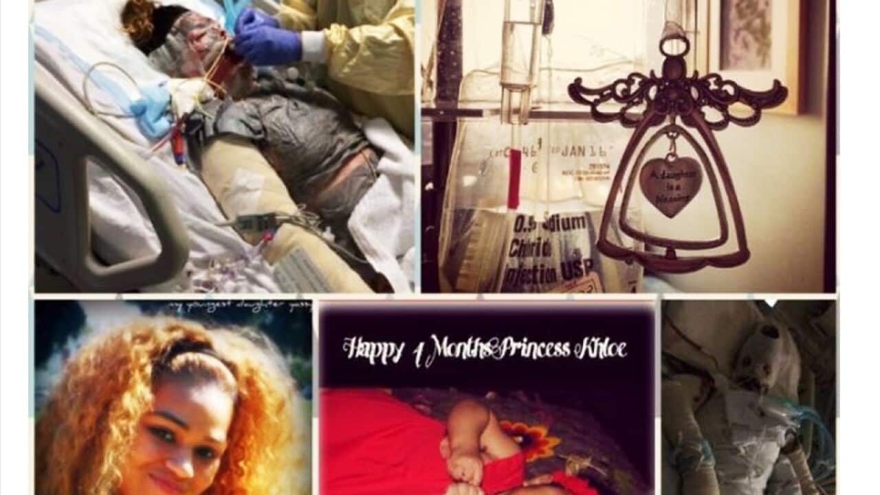 Yassmeen Castanada suffered a rare and severe reaction after taking antibiotics. (http://www.gofundme.com/yaasmeencastanada)