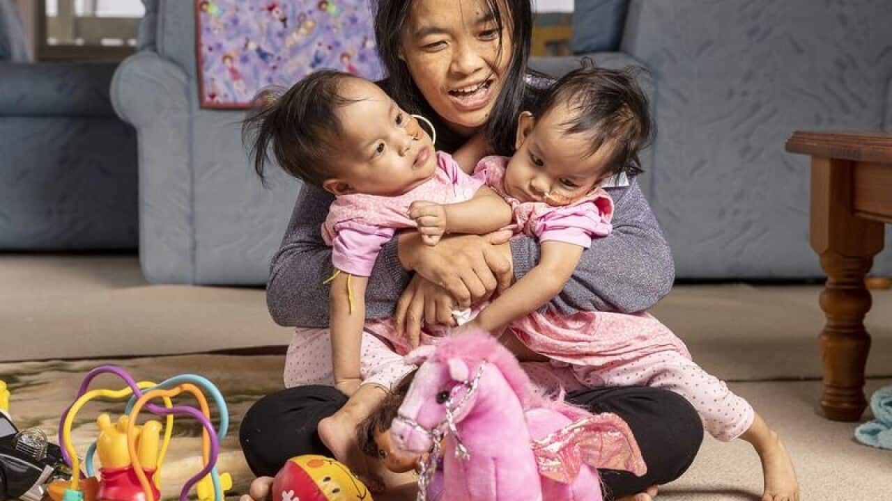 Bhumchu Zangmo is seen holding her conjoined twins Nima and Dawa