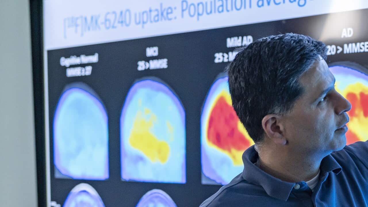 The US Food and Drug Administration issued accelerated approval for the experimental drug Aduhelm, for use in patients with early onset Alzheimer