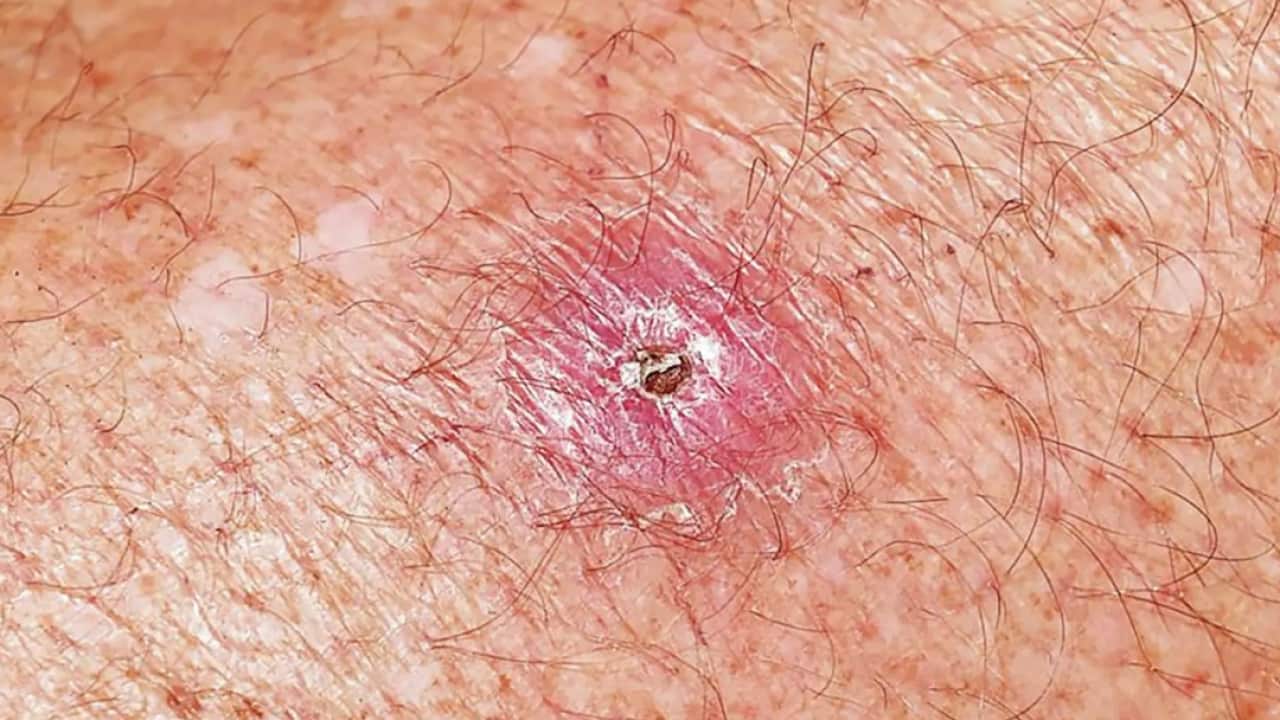 Image for read more article 'READ MORE'