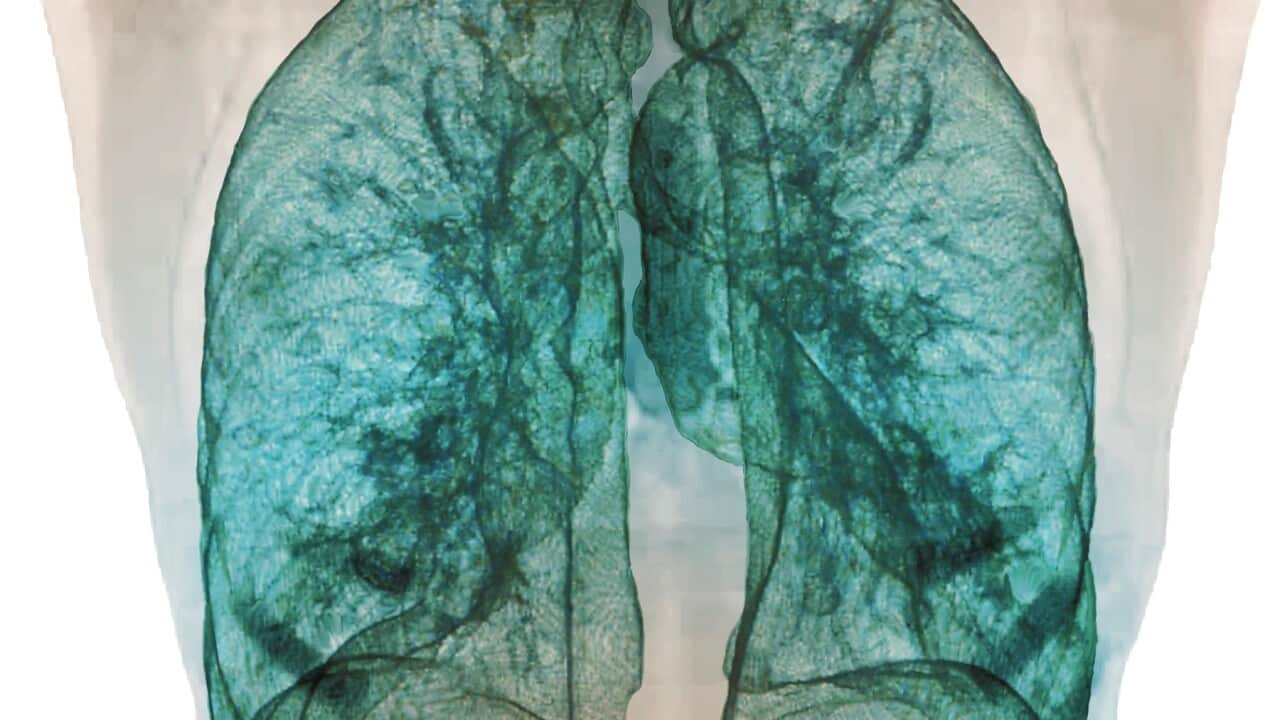 Healthy lungs, 3D CT scan