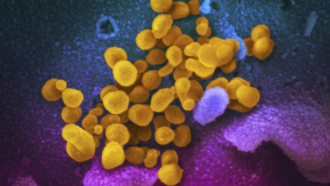 This undated electron microscope image made available by the U.S. National Institutes of Health in February 2020 shows the Novel Coronavirus SARS-CoV-2, yellow, emerging from the surface of cells, blue/pink, cultured in the lab. Also known as 2019-nCoV, t