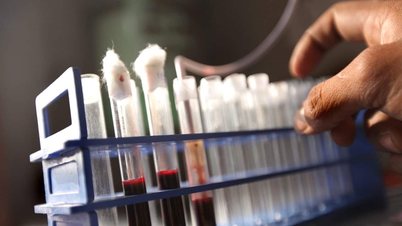 A close up of vials containing blood samples