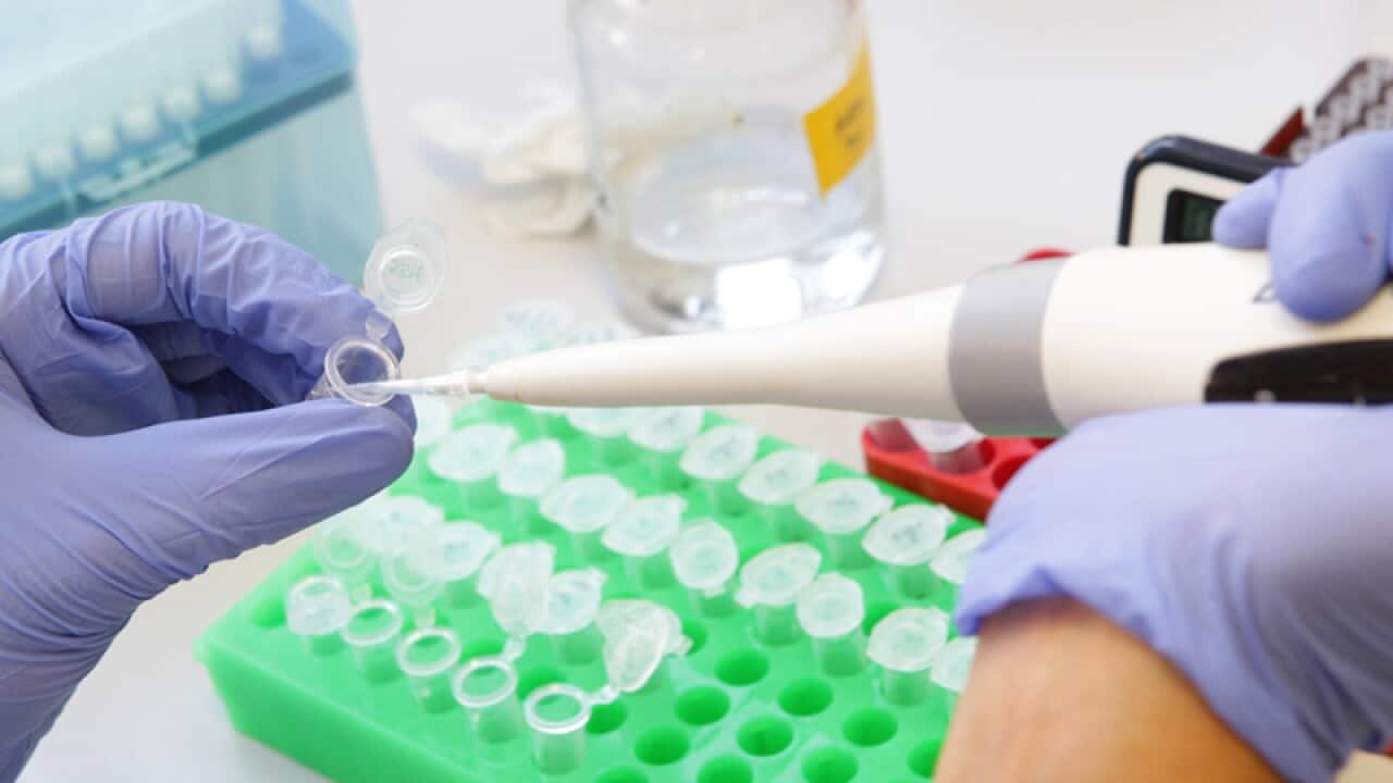A scientist works in a lab at St Vincent's Institute in Melbourne