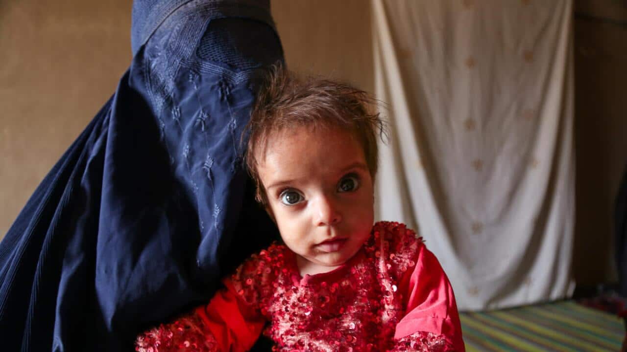Afghan mother Fatima holding her 18-month-old daughter Ara.