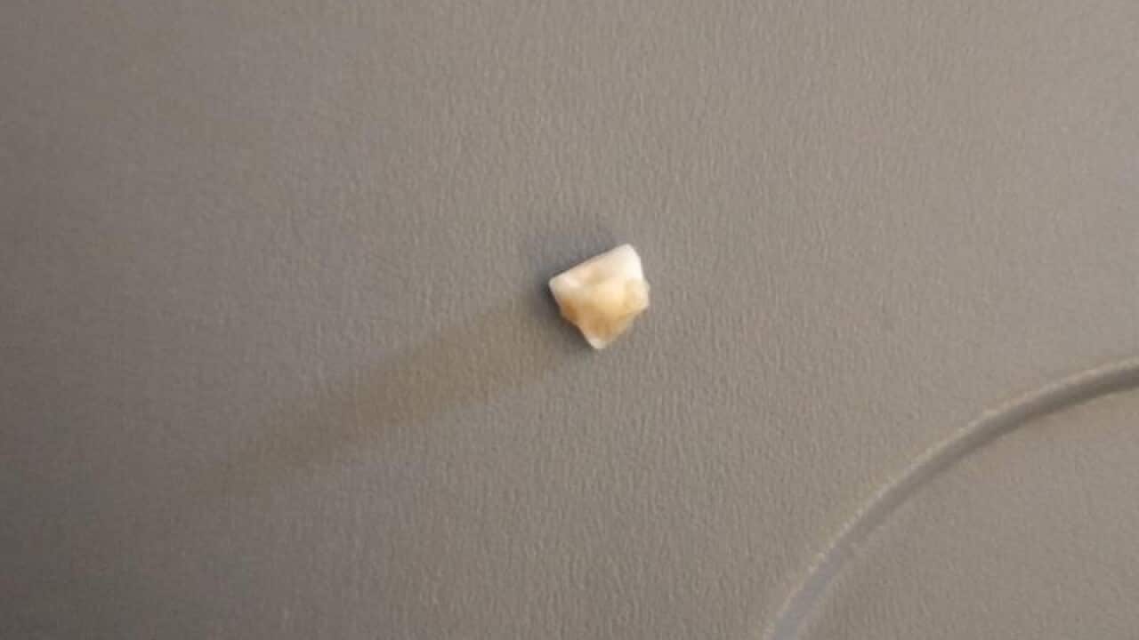 A human tooth on an airline tray.