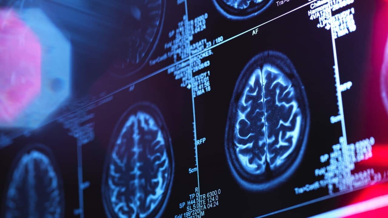Human brain scan in a neurology clinic