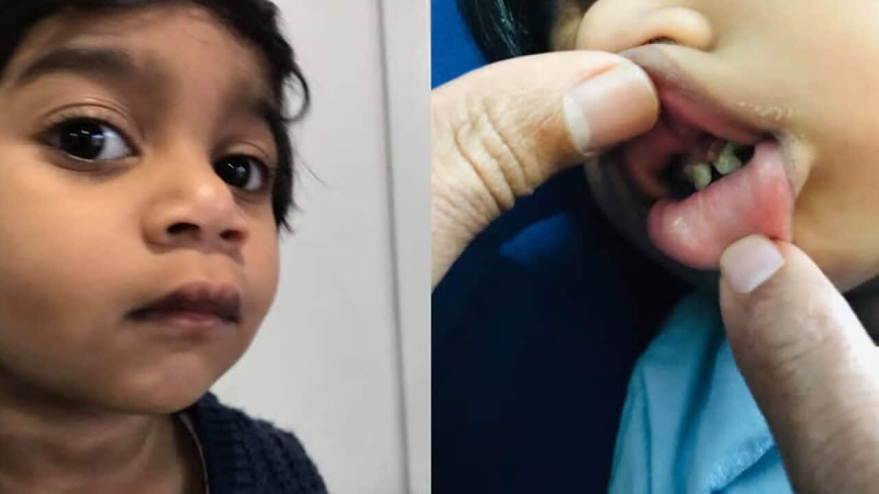 A Tamil child has missed out on dental treatment