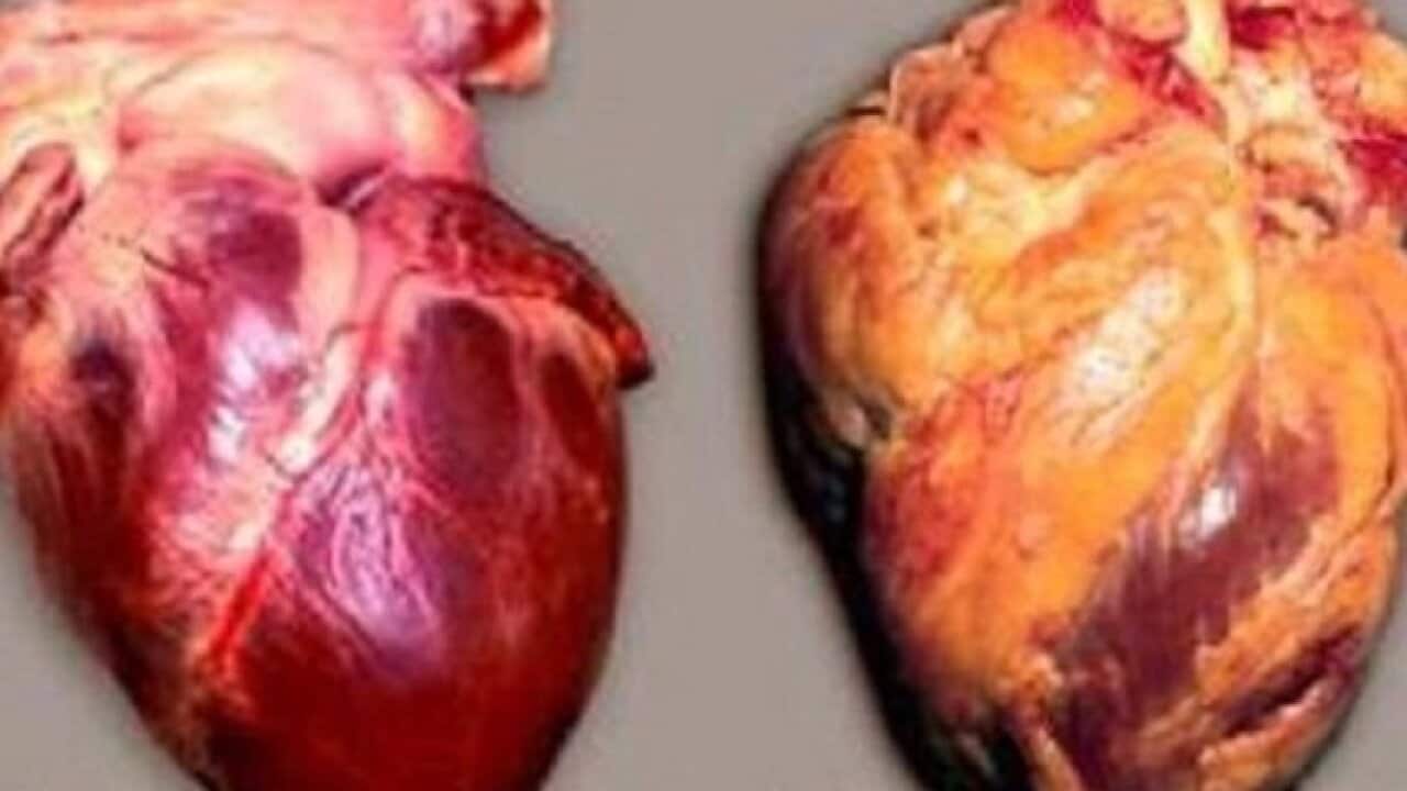تصاویر دو قلب