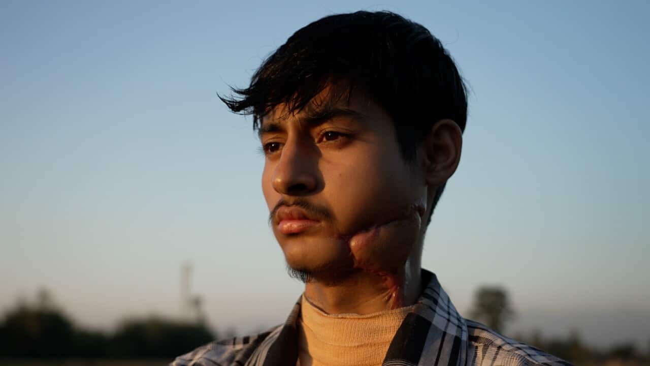 Police shot Shantanu in Nepal’s gen Z uprising. He’s still waiting for justice — and a new face Police shot Shantanu in Nepal’s gen Z uprising. He’s still waiting for justice — and a new face