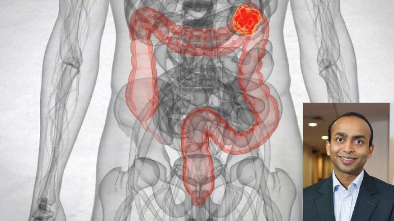 Bowel Cancer