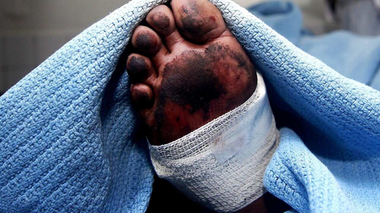 An injured is examined by a doctor, Kenya
