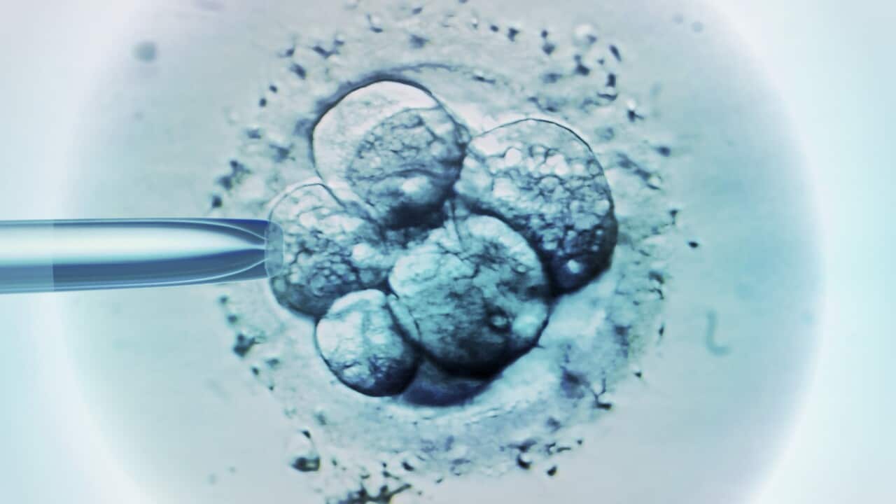 Embryo selection for IVF light micrograph