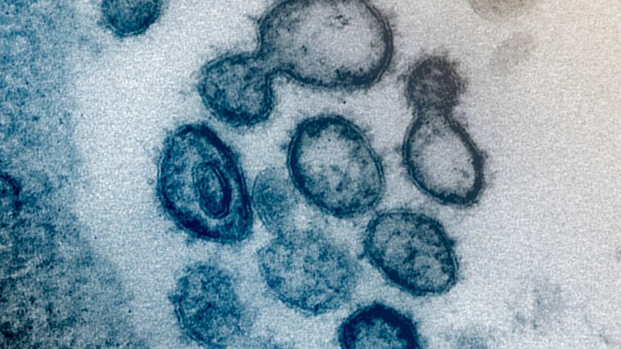 Electron microscope image from the US National Institutes of Health showing the Novel Coronavirus SARS-CoV-2, which causes COVID-19