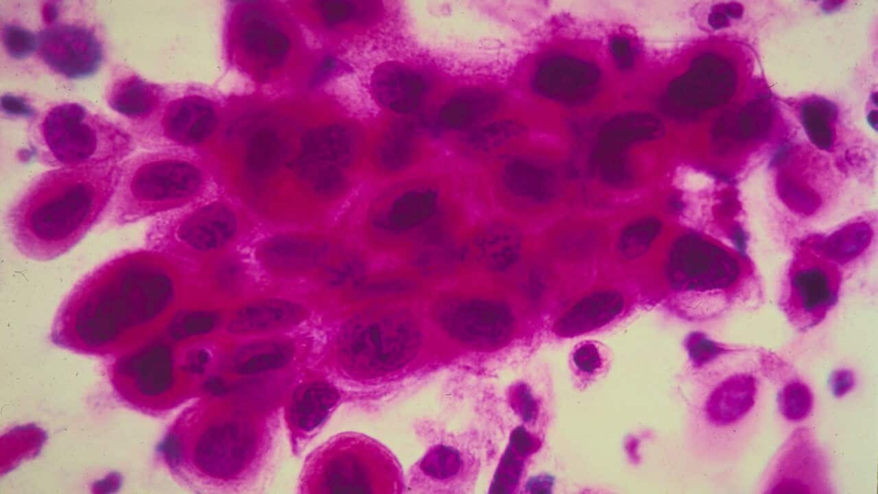 Cancer Images