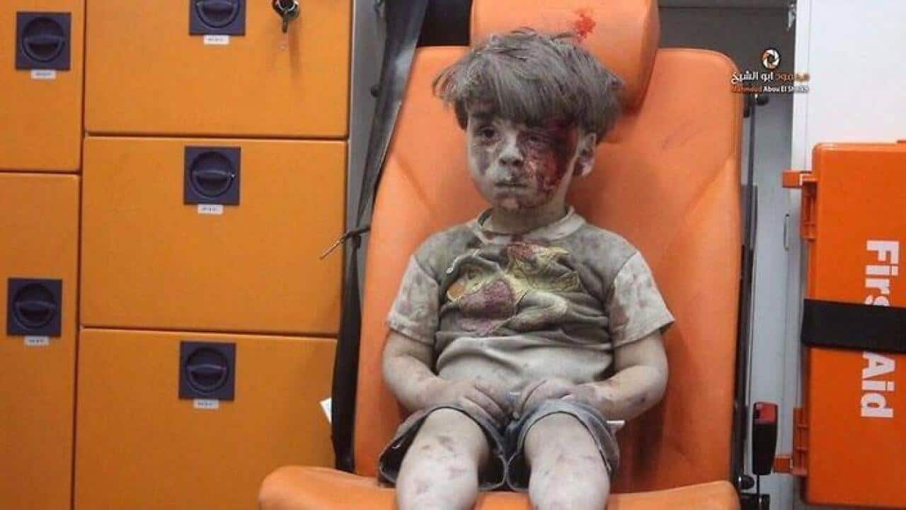 Image of Omran Daqneesh. (Aleppo Media Centre)