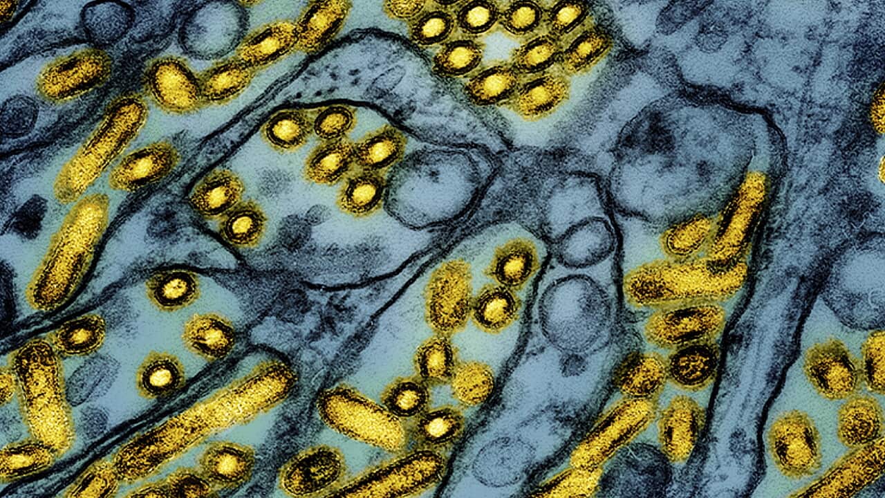 Teenager in critical condition with bird flu in Canada Teenager in critical condition with bird flu in Canada