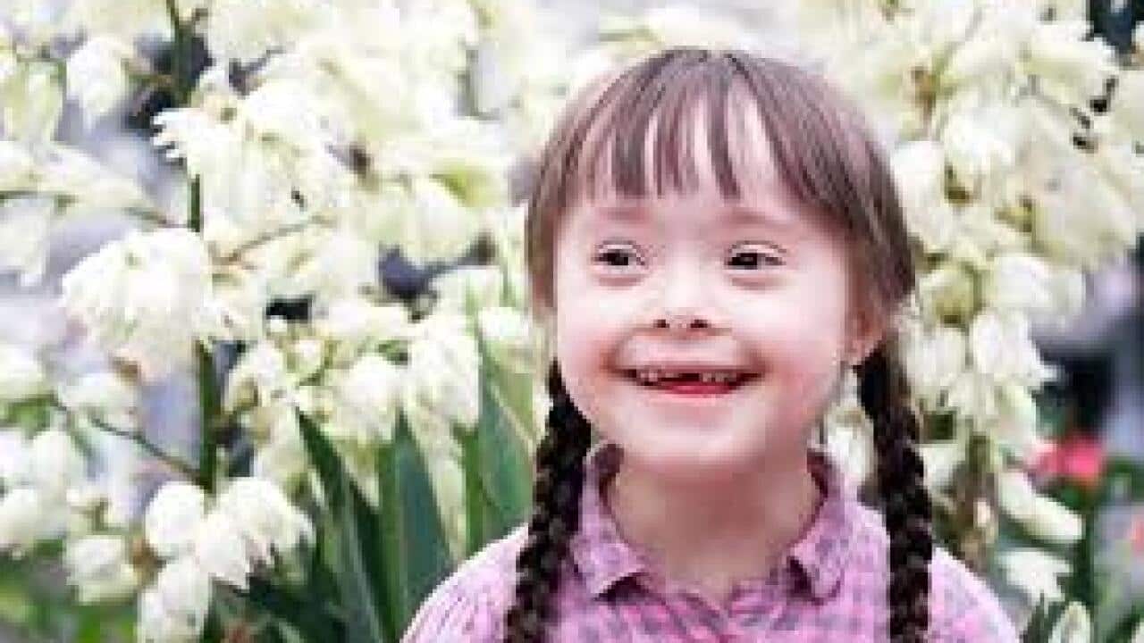 Down Syndrome