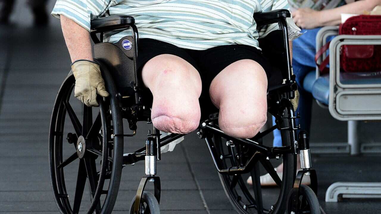 A man in a wheelchair at a Brisbane hospital