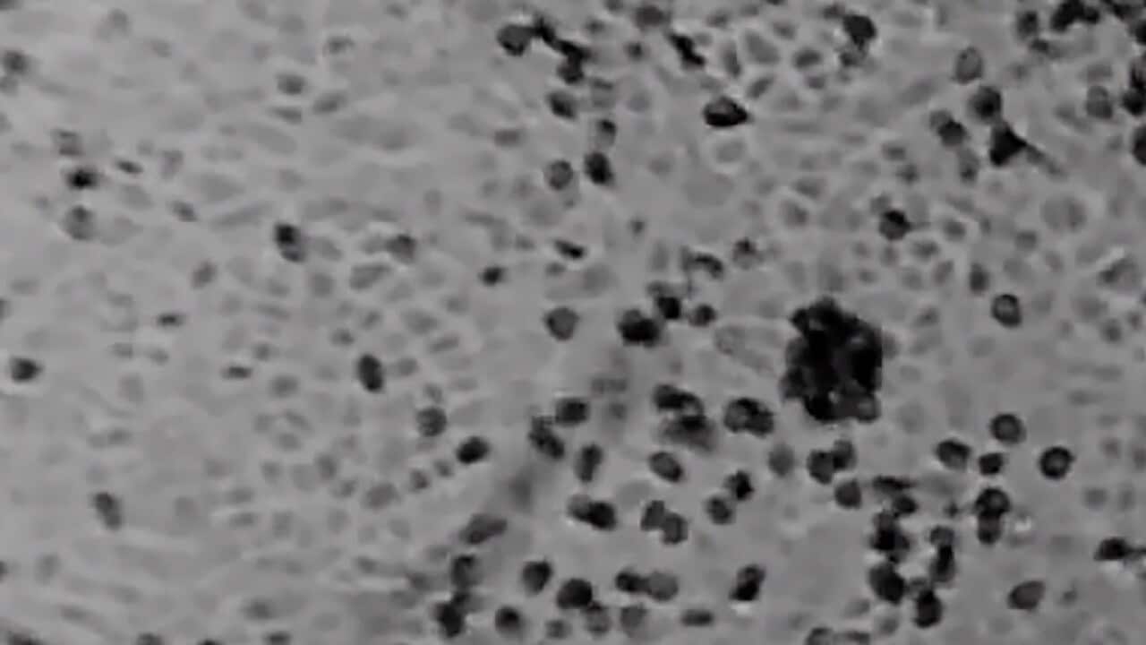 Novel Coronavirus