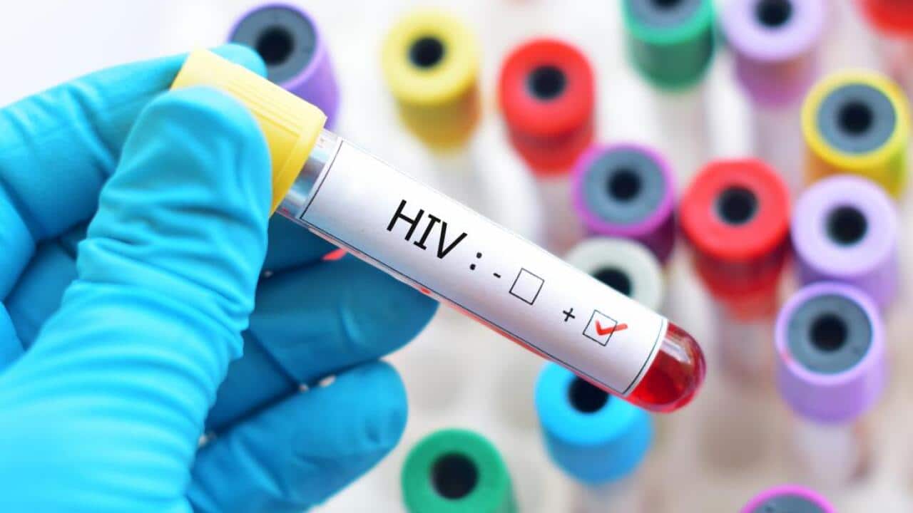 HIV