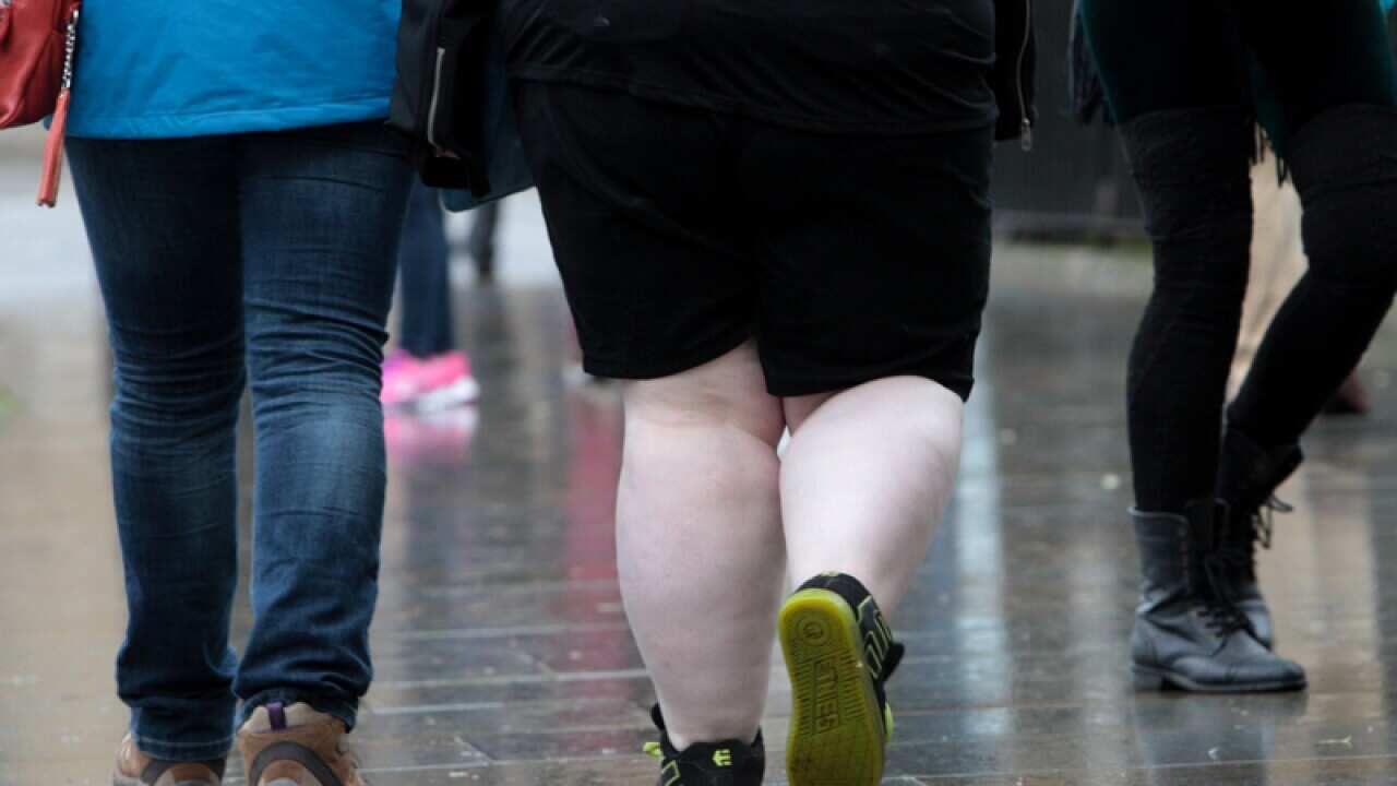 The legs of an overweight woman