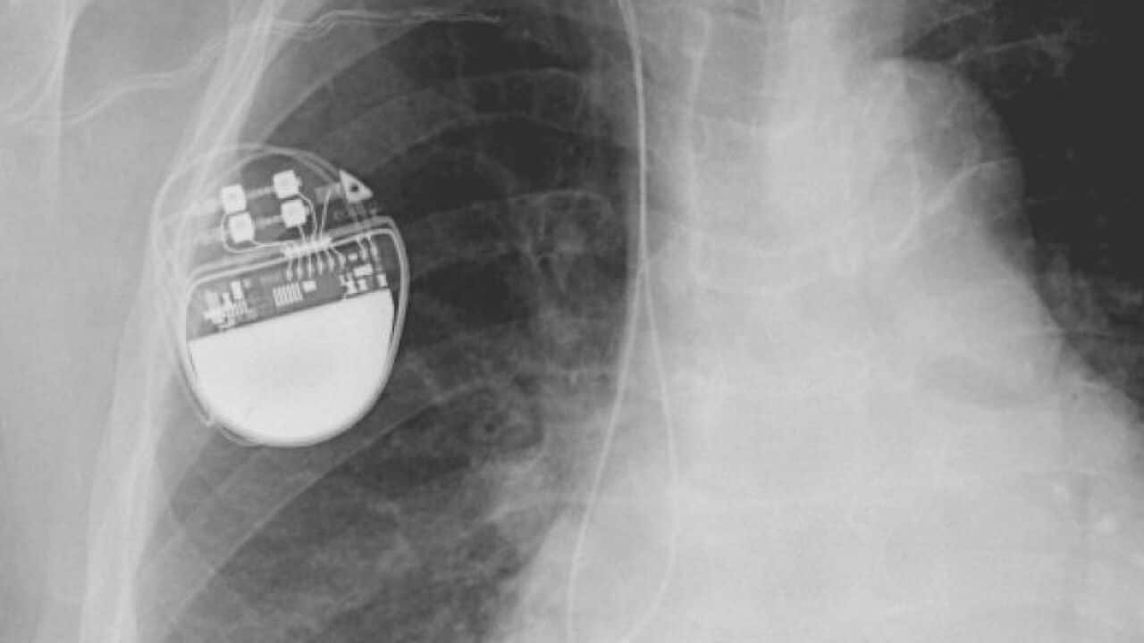 Faulty medical devices have reportedly been used widely due to lax regulation in Europe, a lack of transparency, and poor regulation.