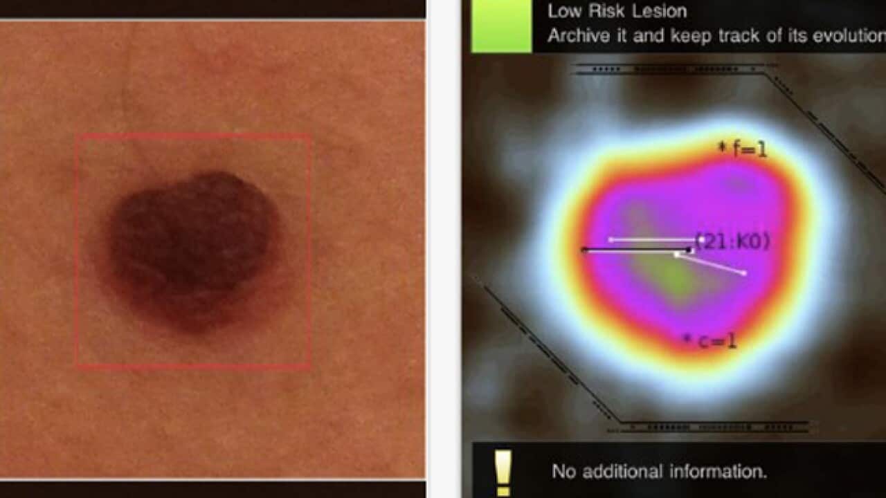 skin_cancer_app_large_1150117002